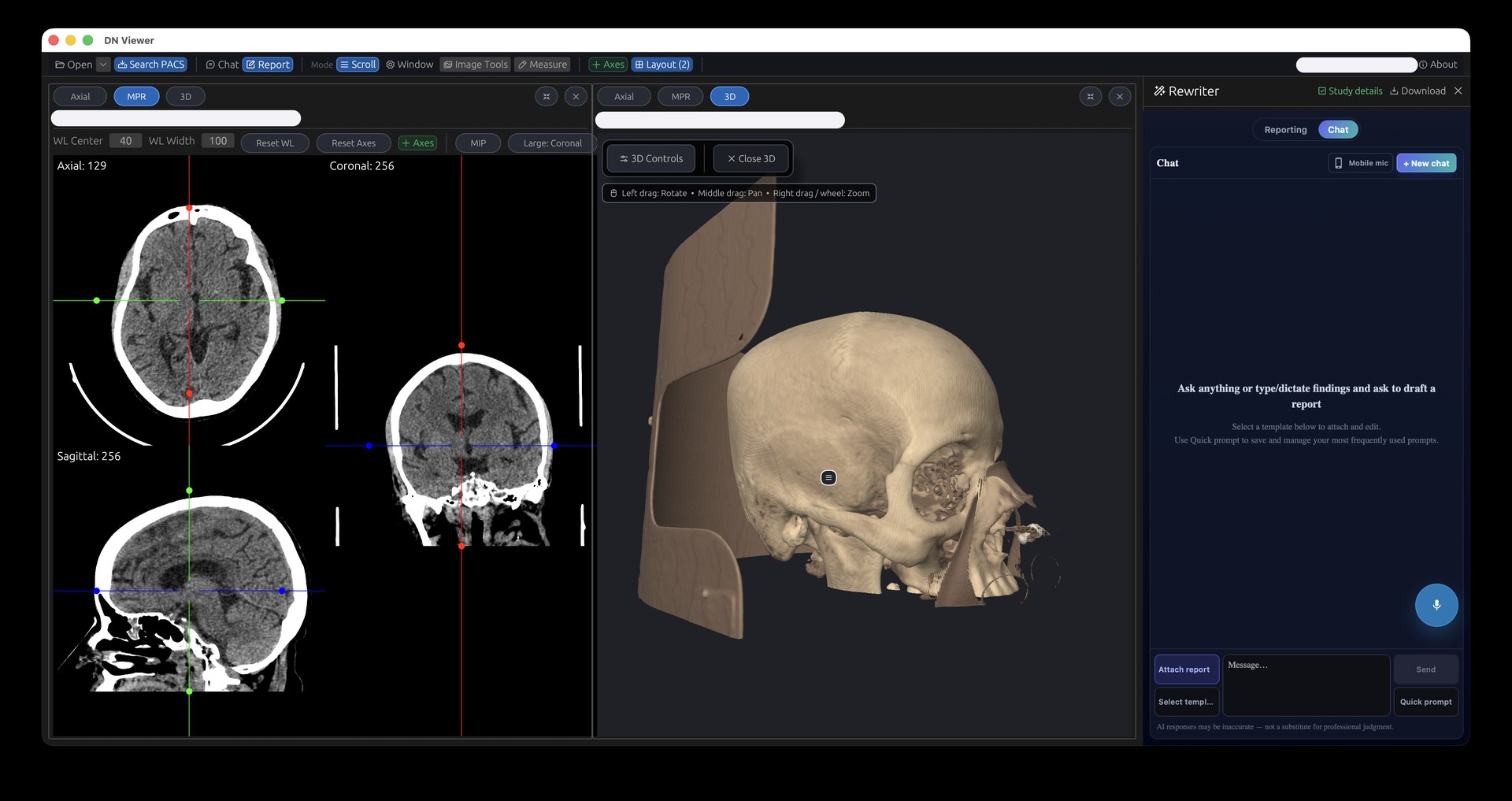 DN Viewer displaying head CT in axial, coronal and sagittal MPR views beside a 3D skull reconstruction and reporting panel